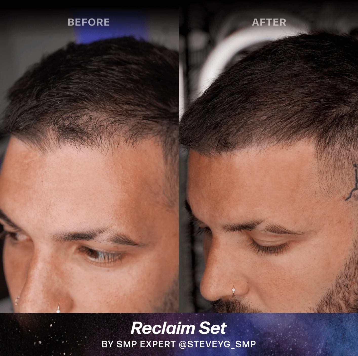 Scalp (SMP) Pigments - Stevey G. Reclaim Set