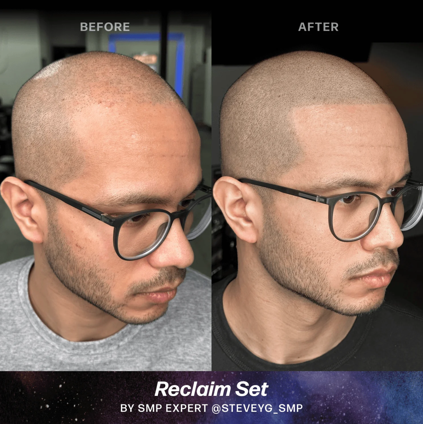 Scalp (SMP) Pigments - Stevey G. Reclaim Set