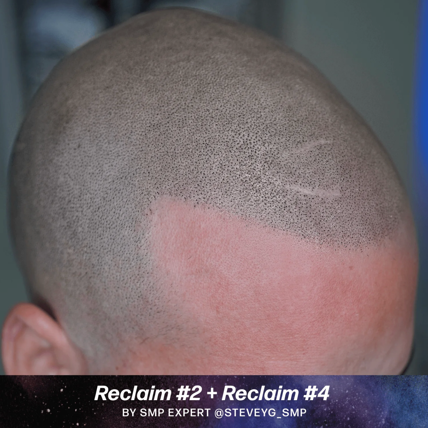 Scalp (SMP) Pigments - Stevey G. Reclaim Set