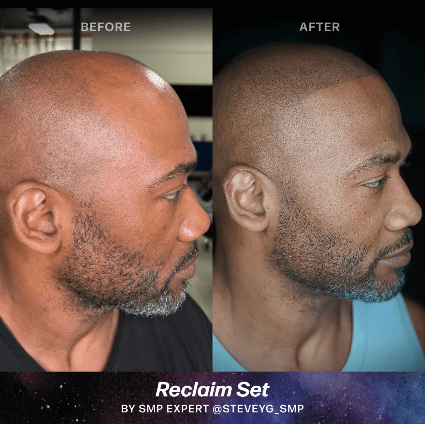 Scalp (SMP) Pigments - Stevey G. Reclaim Set