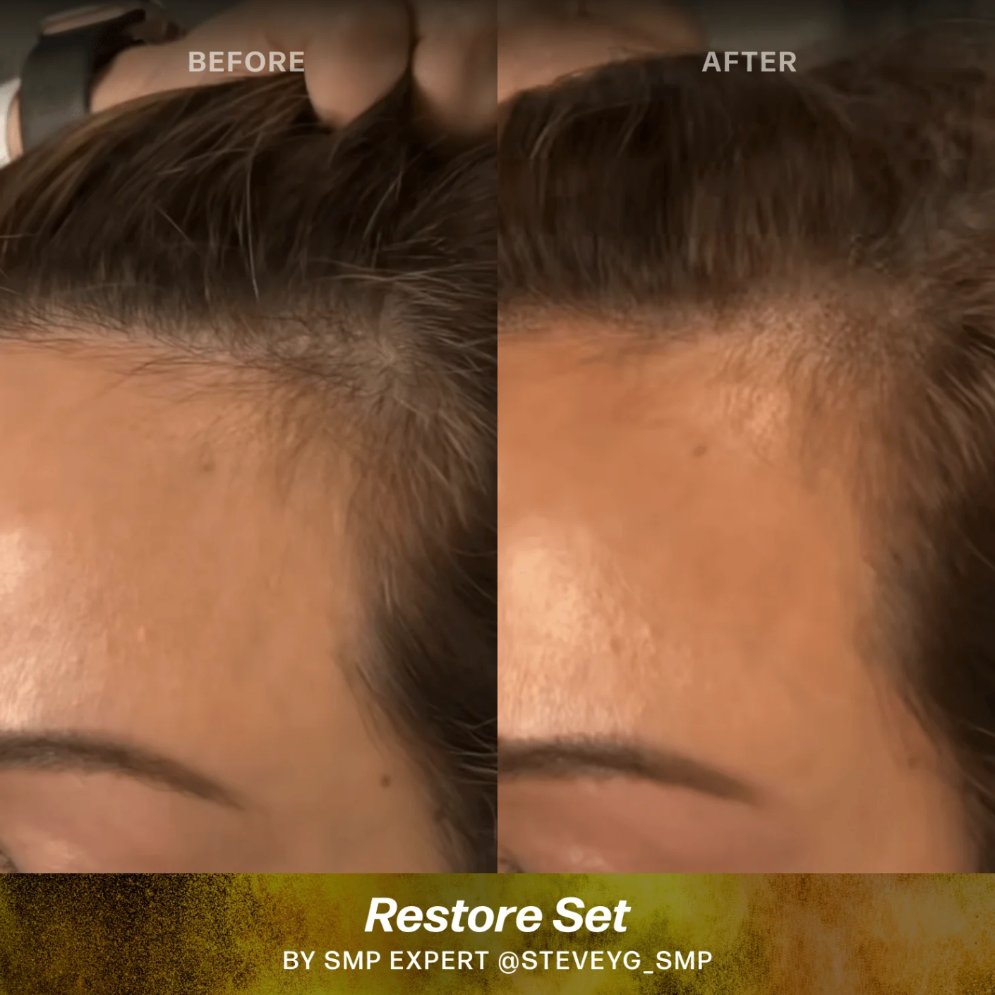 Scalp (SMP) Pigments - Stevey G. Restore Set