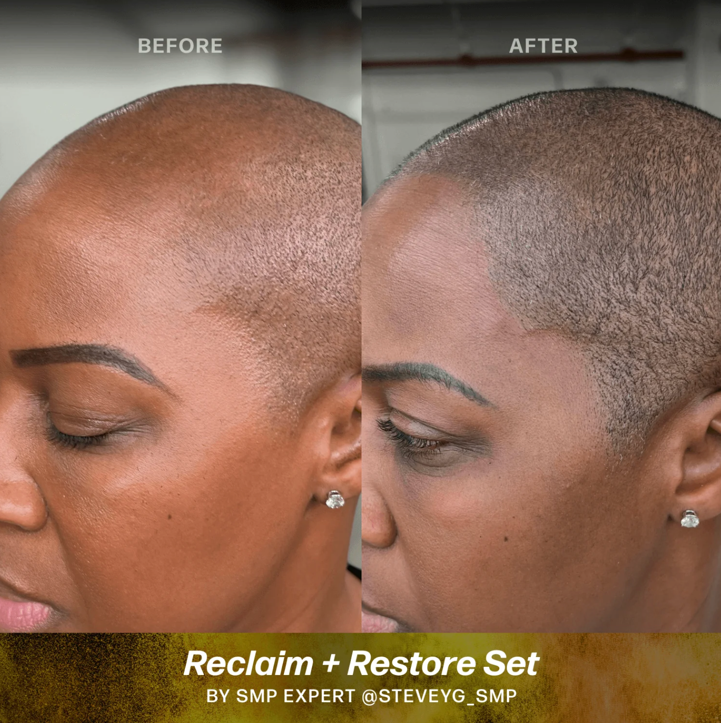 Scalp (SMP) Pigments - Stevey G. Restore Set